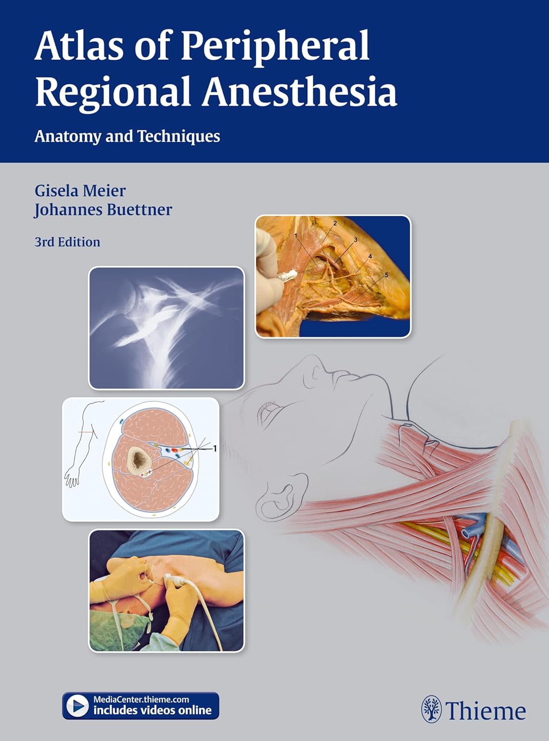 Buy Atlas of Peripheral Regional Anesthesia: Anatomy and Techniques (English, Paperback, Gisela Meier, Johannes Buettner, Johannes Buttner) Online at Best Price - BookBajar