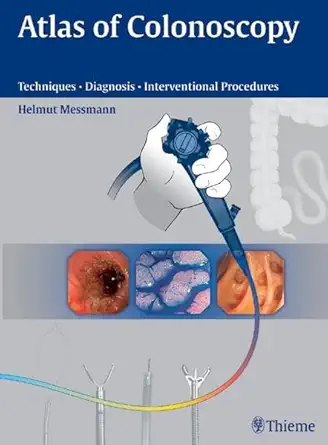 Buy Atlas of Colonoscopy: Examination Techniques and Diagnosis (English, Paperback, Helmut Messmann) Online at Best Price - BookBajar