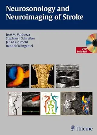 Buy Neurosonology and Neuroimaging of Stroke: A Teaching Atlas (English, Paperback, Jose M. Valdueza) Online at Best Price - BookBajar