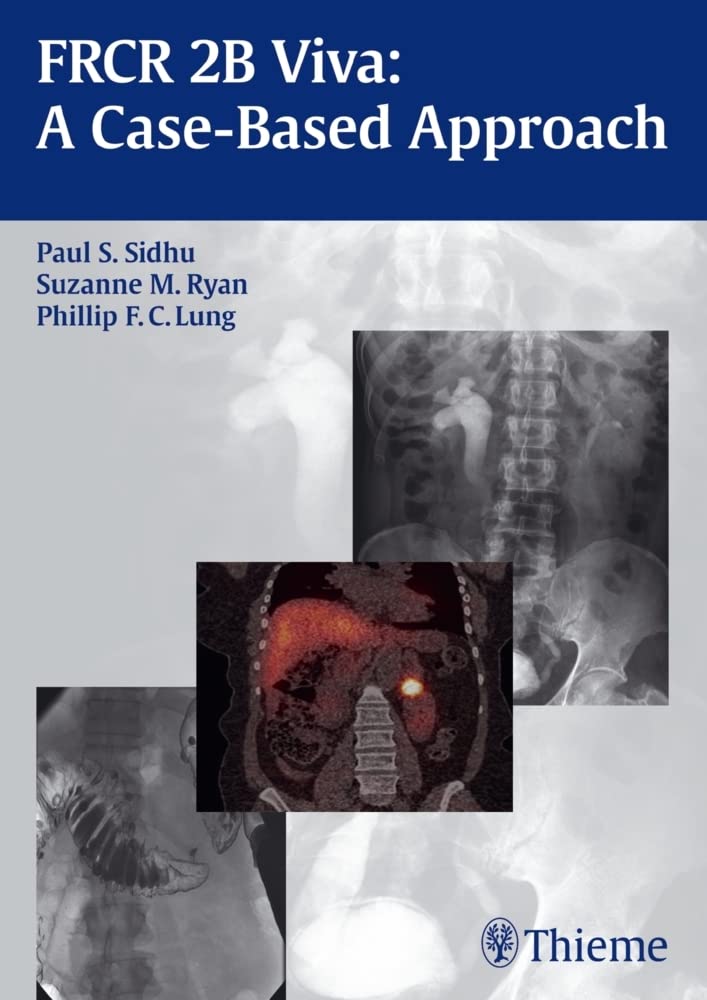 Buy Frcr 2B Viva: A Case-Based Approach: 1/E (English, Paperback, Paul S. Sidhu) Online at Best Price - BookBajar
