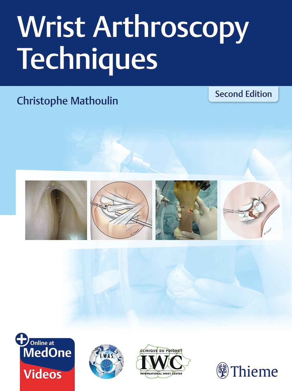 Buy Wrist Arthroscopy Techniques (English, Paperback, Christophe Mathoulin) Online at Best Price - BookBajar