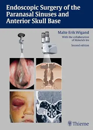 Buy Endoscopic Surgery of the Paranasal Sinuses and Anterior Skull Base (English, Paperback, Malte Erik Wigand) Online at Best Price - BookBajar