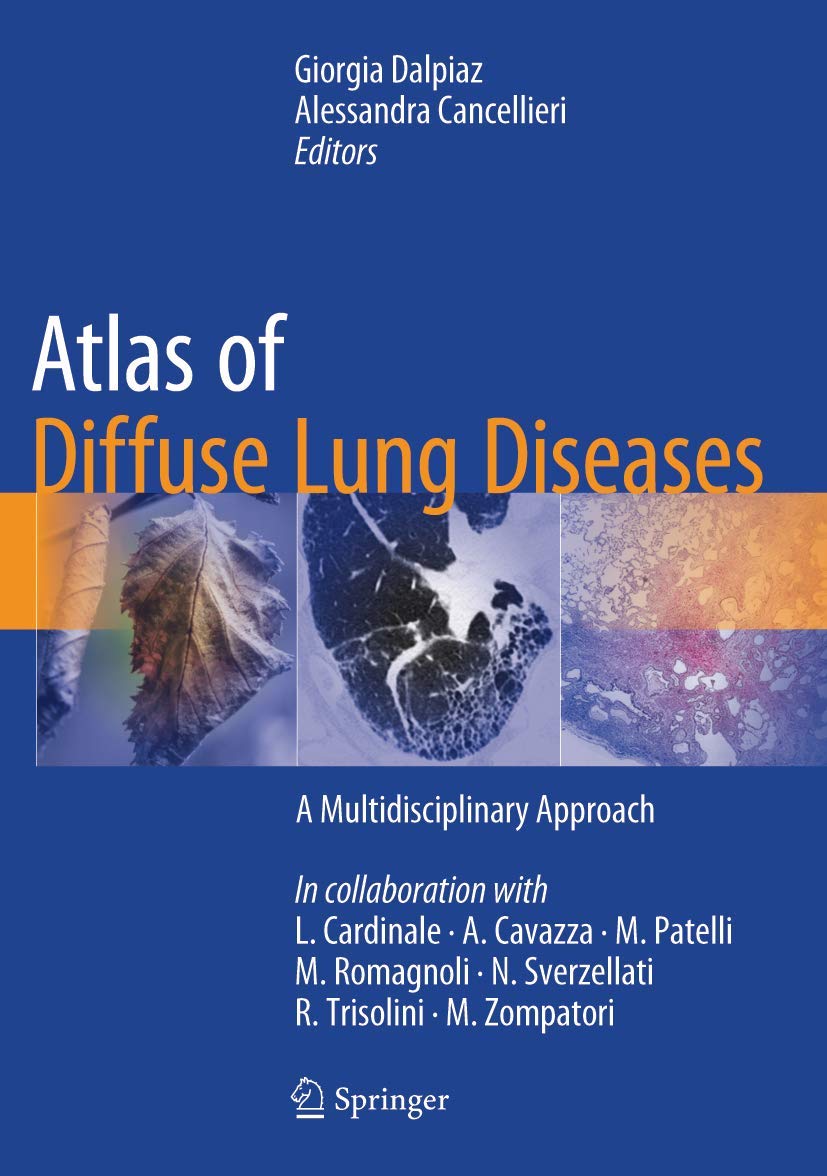 Buy Atlas of Diffuse Lung Diseases: A Multidisciplinary Approach (English, Paperback, Giorgia Dalpiaz, Alessandra Cancellieri) Online at Best Price - BookBajar