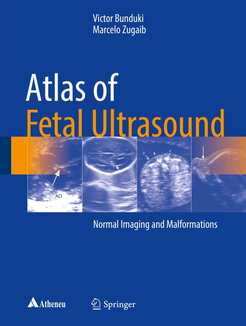 Buy Atlas of Fetal Ultrasound: Normal Imaging and Malformations (English, Paperback, Victor Bunduki, Marcelo Zugaib) Online at Best Price - BookBajar