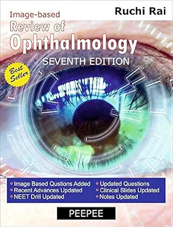 Buy Review of Ophthalmology 7e (English, Paperback, Ruchi Rai) Online at Best Price - BookBajar