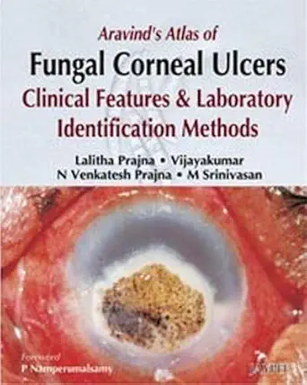 Buy Aravind'S Atlas OF Fungal Corneal Ulcers Clinical Features & LAB.Identification Methods (English, Hardcover, Prajna) Online at Best Price - BookBajar