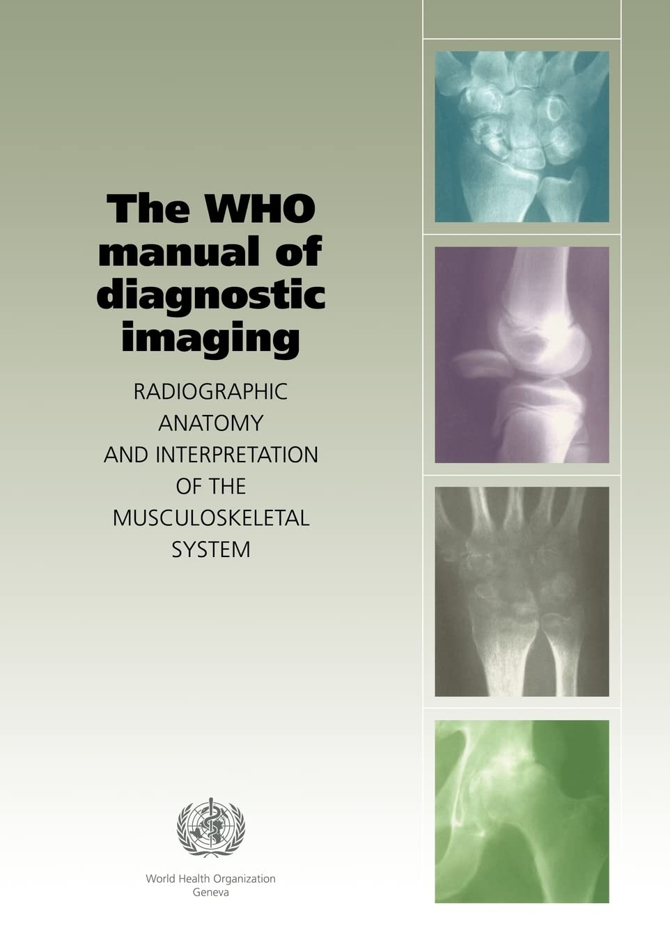Buy Who Manual Of Diagnostic Imaging: Radiographic Anatomy And Interpretation Of The Muskuloskeletal (English, Paperback, A. M. Davies) Online at Best Price - BookBajar