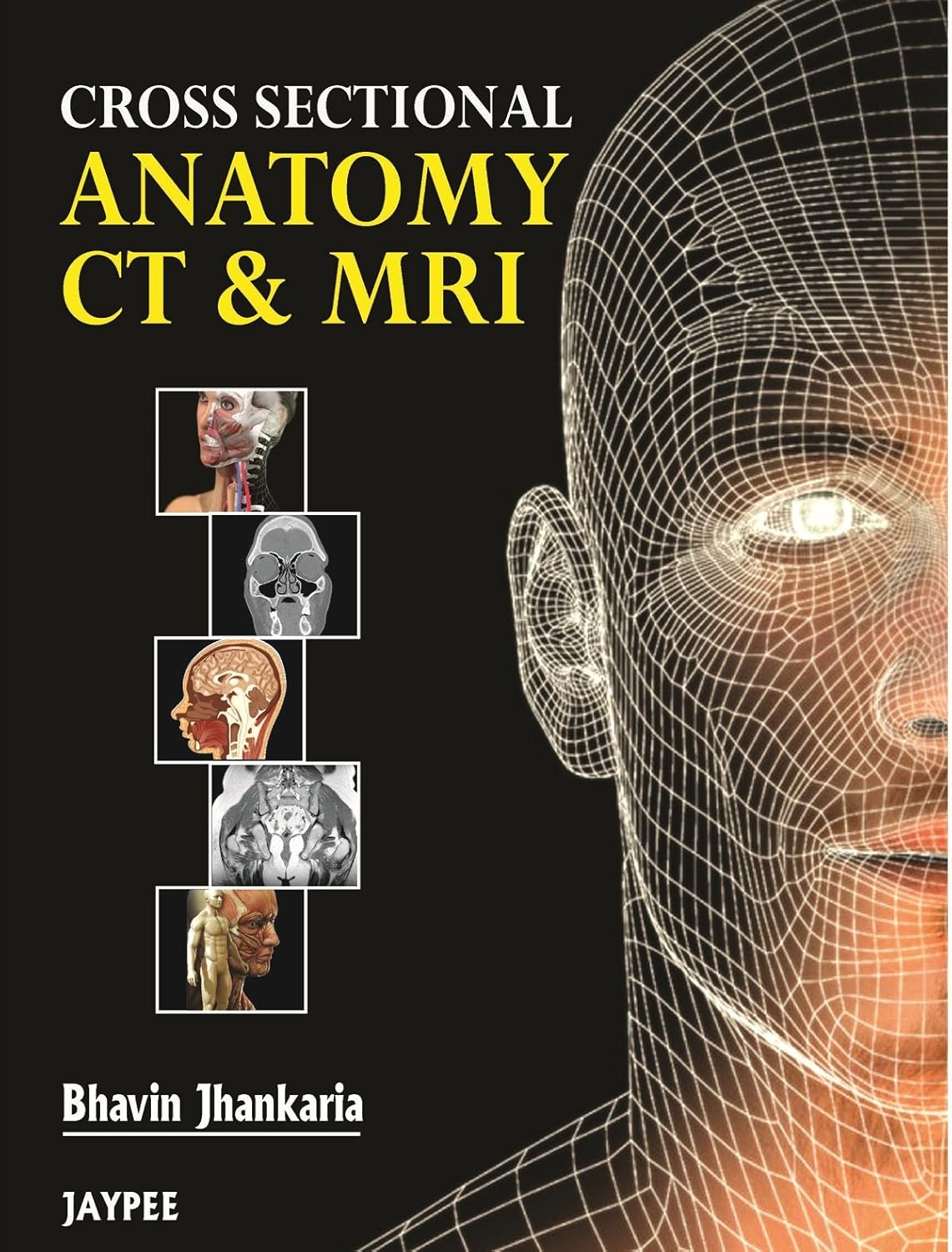 Buy Cross Sectional Anatomy CT & MRI (English, Paperback, Chavhan) Online at Best Price - GlowMirror