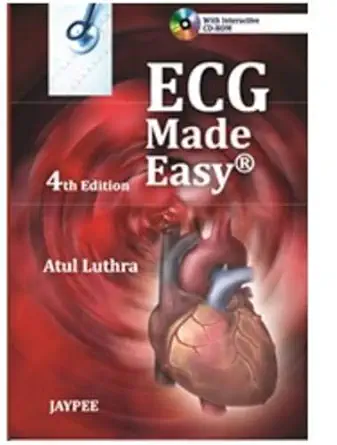Buy Ecg Made Easy with Interactive CD-ROM (English, Paperback, Luthra) Online at Best Price - BookBajar