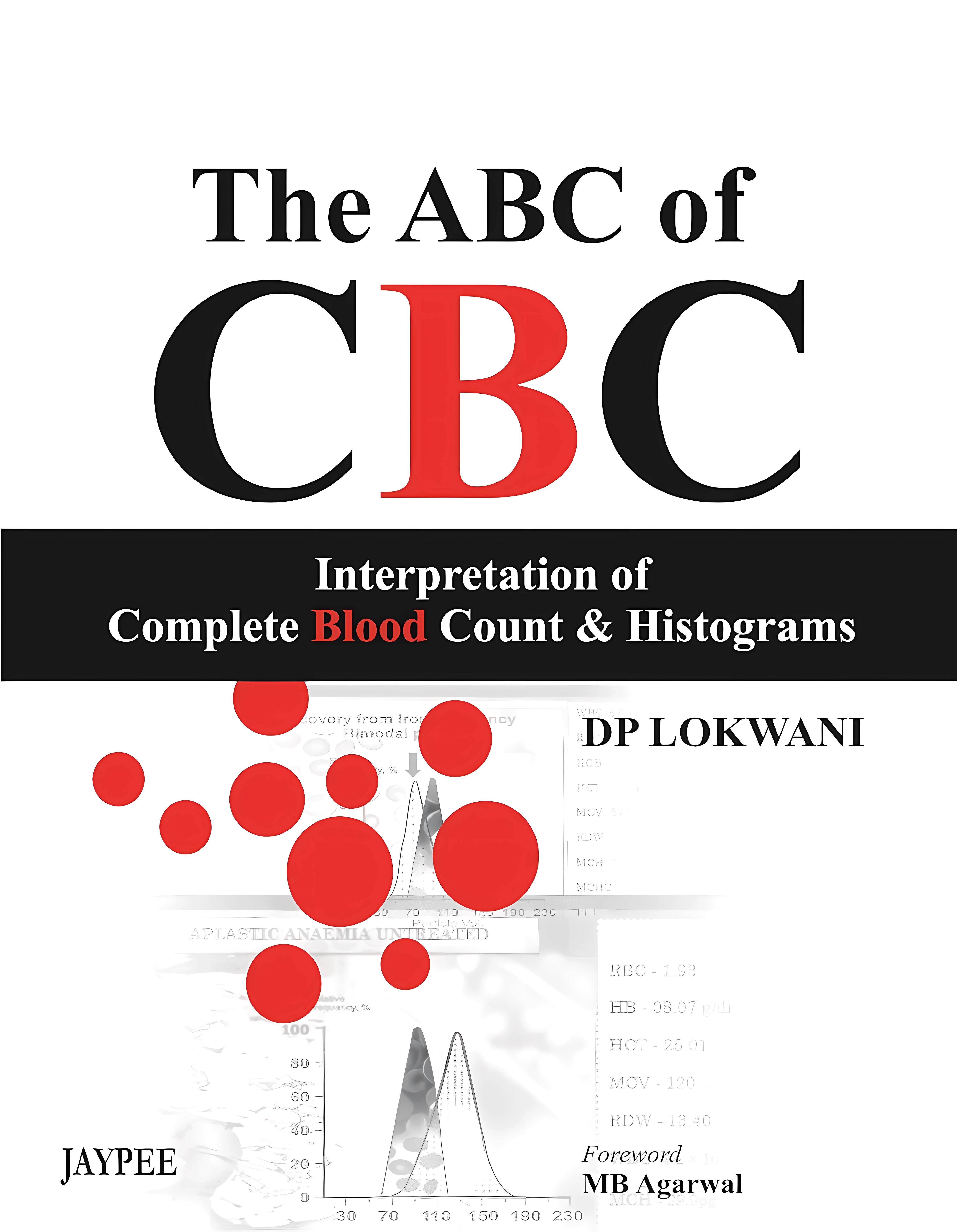 Buy The Abc Of Cbc Interpretation Of Complete Blood Count & Histograms (English, Paperback, Lokwani Dp) Online at Best Price - BookBajar