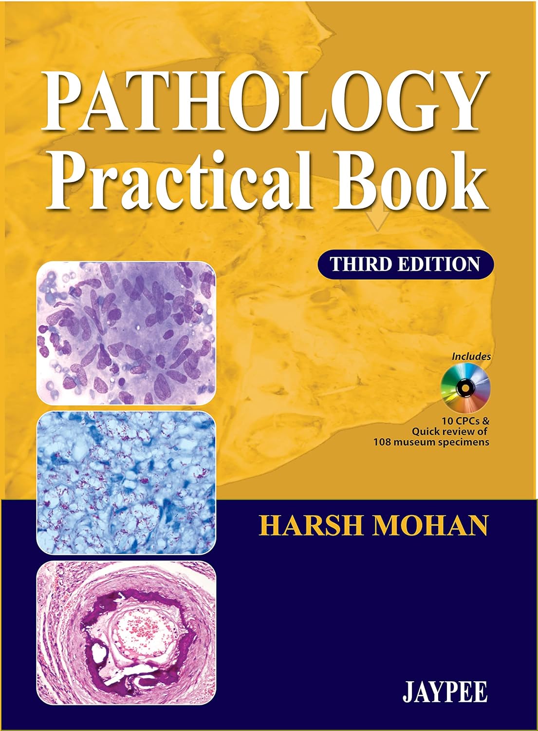 Buy (Old) Pathology Practical Book Includes 10Cpcs & Quick Review Of 108 Museum Specimens (English, Paperback, Harsh Mohan) Online at Best Price - BookBajar