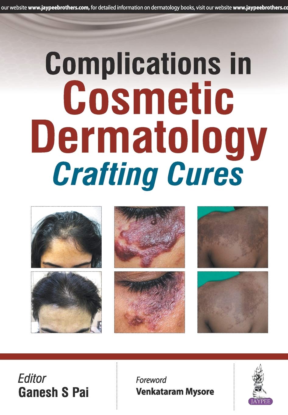 Buy Complications in Cosmetic Dermatology: Crafting Curves (English, Paperback, Pai Ganesh S) Online at Best Price - BookBajar