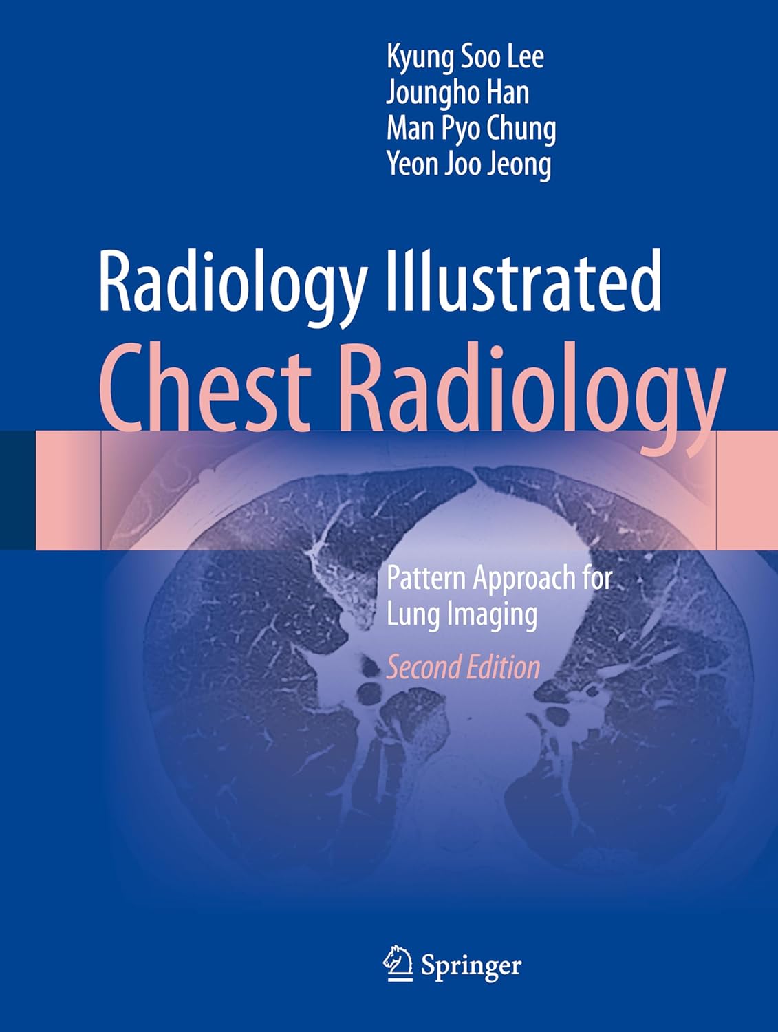 Buy Radiology Illustrated: Chest Radiology: Pattern Approach for Lung Imaging (English, Paperback, Kyung Soo Lee, Joungho Han, Man Pyo Chung, Yeon Joo ... Online at Best Price - BookBajar