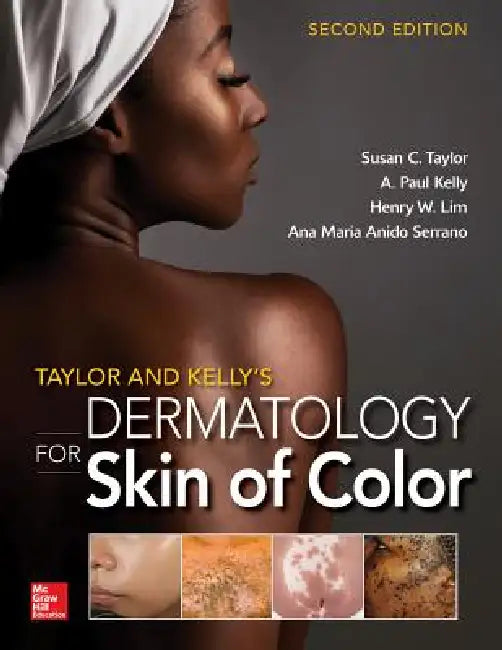 Buy Taylor and Kelly's Dermatology for Skin of Color (English, Susan C. Taylor | A. Paul Kelly | Henry Lim) Online at Best Price - BookBajar