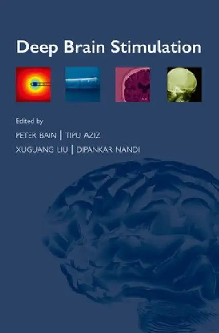Buy Deep Brain Stimulation (English, Peter Bain | Tipu Aziz | Xuguang Liu) Online at Best Price - BookBajar