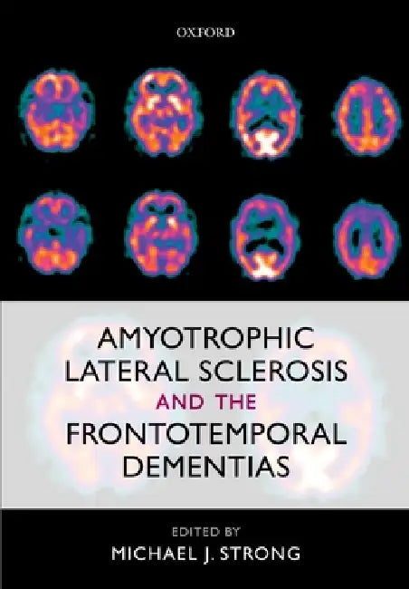 Buy Amyotrophic Lateral Sclerosis and the Frontotemporal Dementias (English, Michael J. Strong) Online at Best Price - BookBajar
