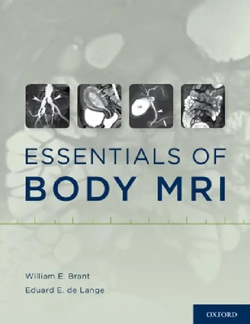 Buy Essentials of Body MRI (English, William E. Brant | Eduard E. de Lange) Online at Best Price - BookBajar