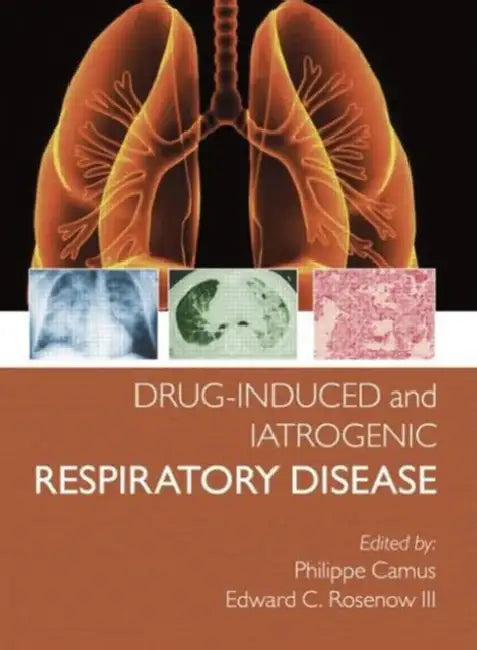 Buy Drug-Induced and Iatrogenic Respiratory Disease (English, Camus Phillipe | Edward Rosenow III) Online at Best Price - BookBajar