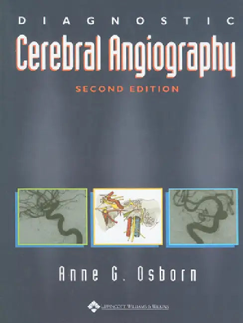 Buy Diagnostic Cerebral Angiography (English, Anne G. Osborn) Online at Best Price - BookBajar