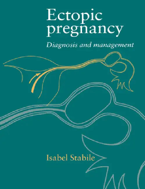 Buy Ectopic Pregnancy (English, Isabel Stabile) Online at Best Price - BookBajar