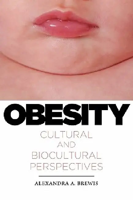 Buy Obesity (English, Alexandra a. Brewis) Online at Best Price - BookBajar