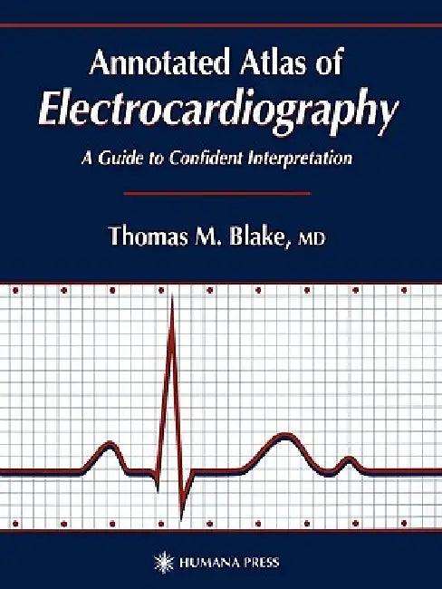 Buy Annotated Atlas of Electrocardiography (English, Thomas M. Blake) Online at Best Price - BookBajar
