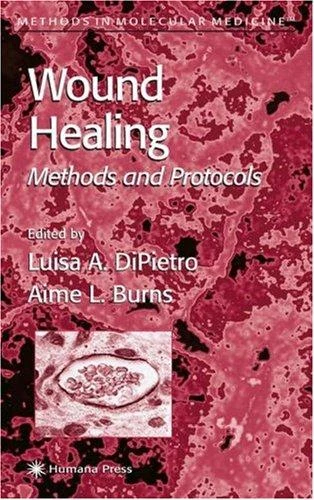 Buy Wound Healing (English, Luisa A. DiPietro | Aime L. Burns) Online at Best Price - BookBajar
