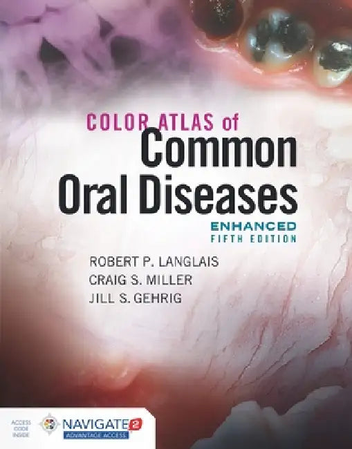 Buy Color Atlas of Common Oral Diseases, Enhanced Edition (English, Robert P. Langlais | Craig S. Miller | Jill S. Gehrig) Online at Best Price - BookBajar