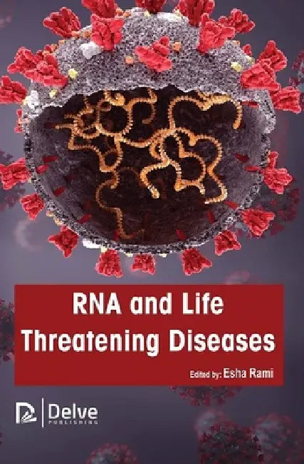 Buy RNA and Life Threatening Diseases (English, Esha Rami) Online at Best Price - BookBajar