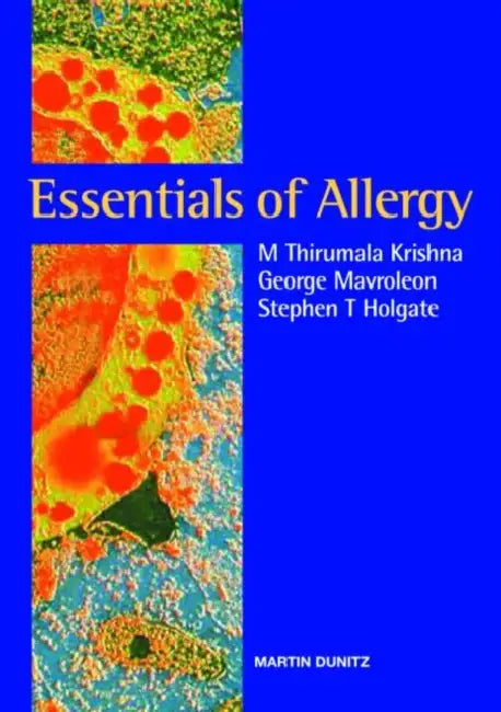 Buy Essentials of Allergy (English, M. Thirumala Krishna | George Mavroleon | Stephen T. Holgate) Online at Best Price - BookBajar