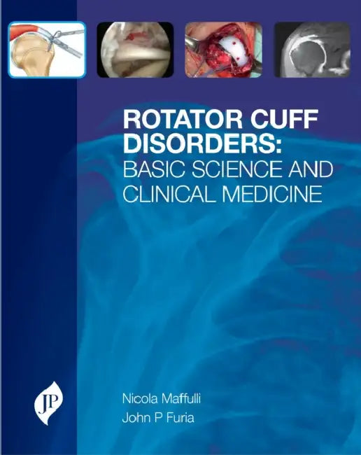 Buy Rotator Cuff Disorders (English, Nicola Maffulli) Online at Best Price - BookBajar
