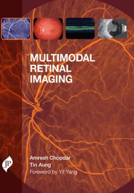 Buy Multimodal Retinal Imaging (English, Amresh Chopdar) Online at Best Price - BookBajar