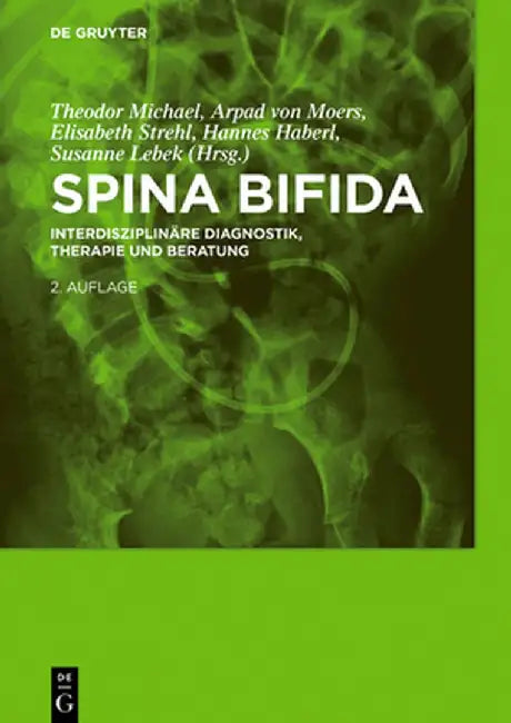 Buy Spina Bifida (English, Theodor Michael) Online at Best Price - BookBajar