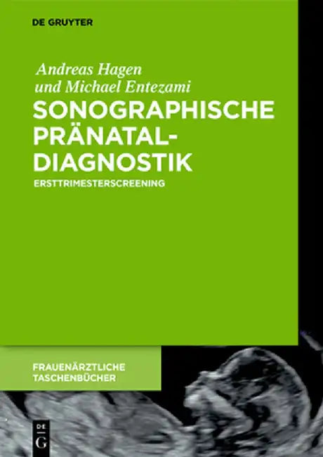 Buy Sonographische Pränataldiagnostik (English, Andreas Hagen) Online at Best Price - BookBajar
