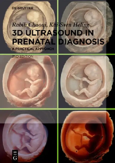 Buy 3D Ultrasound in Prenatal Diagnosis (English, Rabih Chaoui) Online at Best Price - BookBajar