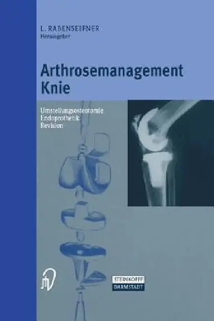 Buy Arthrosemanagement Knie (English, L. Rabenseifner) Online at Best Price - BookBajar