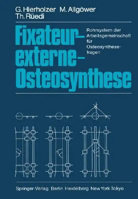 Buy Fixateur-Externe-Osteosynthese (English, G. Hierholzer | M. Allgöwer | T. Rüedi) Online at Best Price - BookBajar