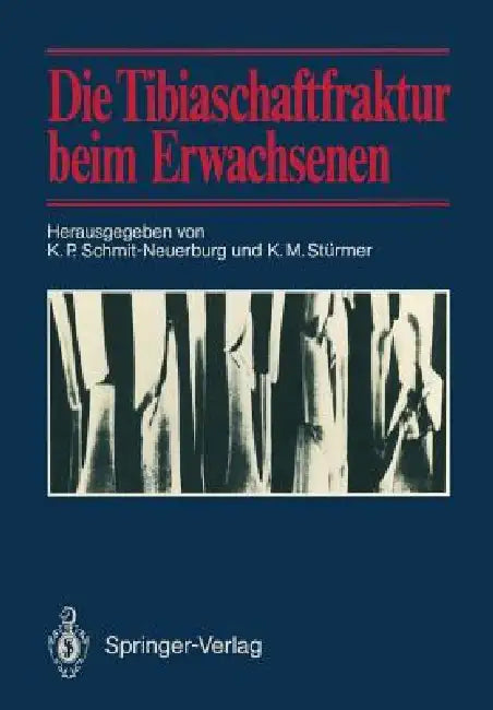 Buy Die Tibiaschaftfraktur Beim Erwachsenen (English, K. P. Schmit-Neuerburg | K. M. Stürmer) Online at Best Price - BookBajar