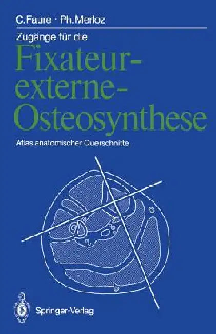 Buy Zugänge Für Die Fixateur-Externe-Osteosynthese (English, Claude Faure | Thomas Lederer | Philippe Merloz) Online at Best Price - BookBajar