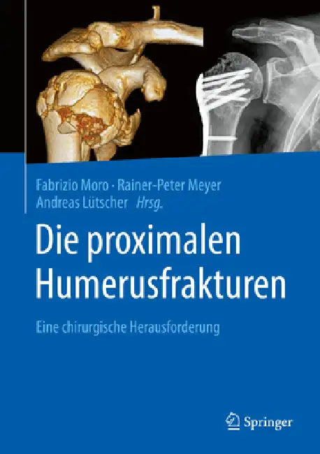 Buy Die Proximalen Humerusfrakturen (English, Fabrizio Moro | Rainer-Peter Meyer | Andreas Lütscher) Online at Best Price - BookBajar