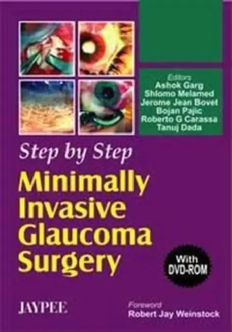 Buy Step By Step Minimally Invasive Glaucoma Surgery With Dvd-Rom (English, Ashok Garg) Online at Best Price - BookBajar