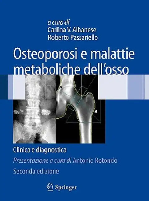 Buy Osteoporosi E Malattie Metaboliche Dell'osso (English, Carlina V. Albanese | Roberto Passariello) Online at Best Price - BookBajar