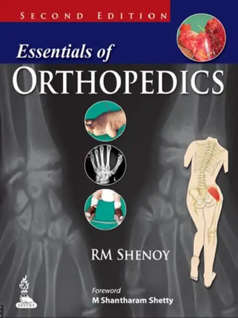 Buy Essentials Of Orthopedics (English, RM Shenoy) Online at Best Price - BookBajar