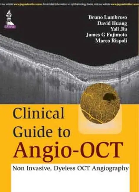 Buy Clinical Guide To Angio-Oct (English, Bruno Lumbroso) Online at Best Price - BookBajar