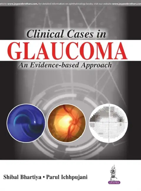 Buy Clinical Cases In Glaucoma An Evidence-Based Approach (English, Shibal Bhartiya) Online at Best Price - BookBajar